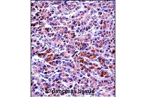 PRSS2 Antibody (Center) ((ABIN657641 and ABIN2846637))immunohistochemistry analysis in formalin fixed and paraffin embedded human pancreas tissue followed by peroxidase conjugation of the secondary antibody and DAB staining.