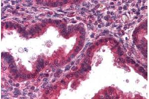 Human Uterus, Endometrium (formalin-fixed, paraffin-embedded) stained with DCN antibody ABIN298189 at 2. (Decorin 抗体)