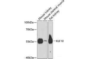 Western blot analysis of extracts of various cell lines using KLF10 Polyclonal Antibody at dilution of 1:3000. (KLF10/TIEG1 抗体)