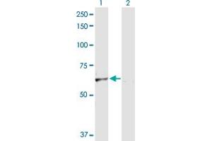 Western Blotting (WB) image for anti-Solute Carrier Family 40 (Iron-Regulated Transporter), Member 1 (SLC40A1) (AA 1-571) antibody (ABIN526239)