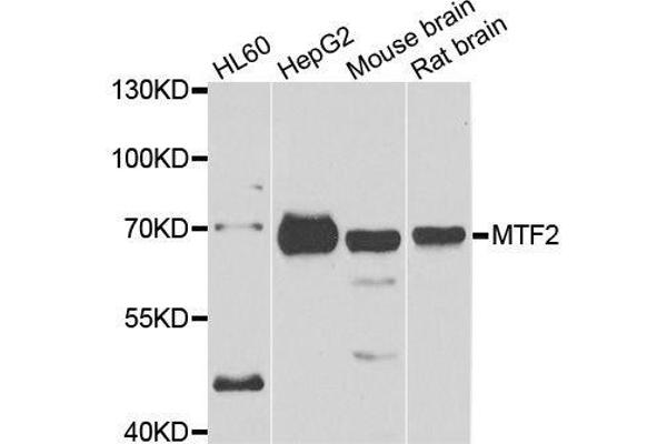MTF2 抗体  (AA 1-190)