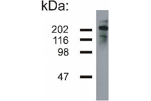 Western blotting analysis of neurofilament heavy protein in porcine brain lysate (reducing conditions) by mouse monoclonal NF-05 . (NEFH 抗体)