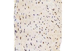 Immunohistochemistry of paraffin embedded mouse heart using smad62024 (ABIN7075629) at dilution of 1:1000 (400x lens) (SMAD6 抗体)