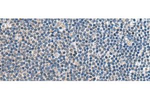 Immunohistochemistry of paraffin-embedded Human tonsil tissue using CNTN4 Polyclonal Antibody at dilution of 1:65(x200) (Contactin 4 抗体)