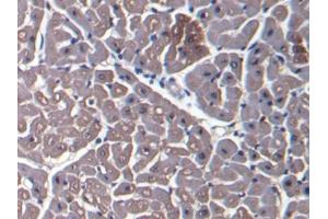 DAB staining on IHC-P; Samples: Bovine Cardiac Muscle Tissue (Myoglobin 抗体  (AA 1-154))