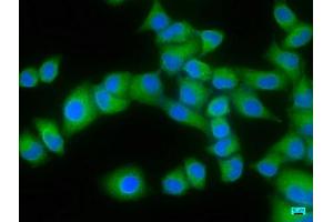 Immunofluorescence staining of Hela cells with ABIN7152094 at 1:166, counter-stained with DAPI. (ELF3 抗体  (AA 147-371))
