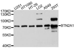 Western blot analysis of extracts of various cell lines, using BTN2A1 antibody. (BTN2A1 抗体  (AA 30-240))
