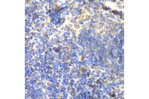 Immunohistochemistry (IHC) image for anti-Bruton Agammaglobulinemia tyrosine Kinase (BTK) (AA 30-240) antibody (ABIN3022171)