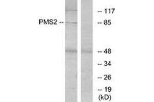 Western Blotting (WB) image for anti-PMS2 Postmeiotic Segregation Increased 2 (S. Cerevisiae) (PMS2) (AA 461-510) antibody (ABIN2890024) (PMS2 抗体  (AA 461-510))