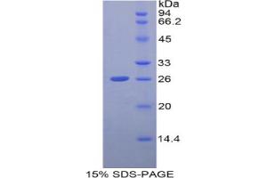 SDS-PAGE analysis of Human GCLC Protein. (GCLC 蛋白)