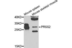 Western blot analysis of extracts of various cell lines, using PRSS2 antibody. (PRSS2 抗体)