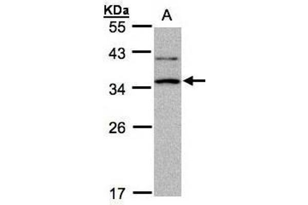 XRCC2 抗体  (N-Term)