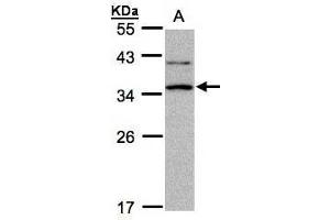 WB Image Sample A: 30μg of Raji whole cell lysate , 12% SDS PAGE antibody diluted at 1:1000 (XRCC2 抗体  (N-Term))