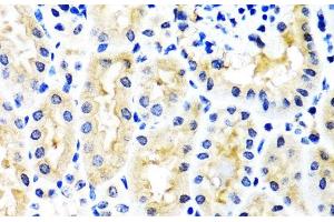 Immunohistochemistry of paraffin-embedded Mouse kidney using SNAP29 Polyclonal Antibody at dilution of 1:100 (40x lens). (SNAP29 抗体)