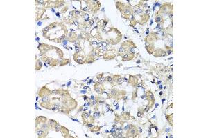 Immunohistochemistry of paraffin-embedded human stomach using BCS1L antibody (ABIN5975615) at dilution of 1/100 (40x lens). (BCS1L 抗体)