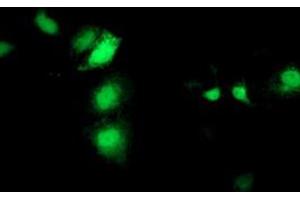 Anti-SEC14L2 mouse monoclonal antibody (ABIN2455150) immunofluorescent staining of COS7 cells transiently transfected by pCMV6-ENTRY SEC14L2 (RC215994). (SEC14L2 抗体)