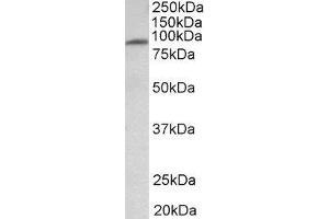 ABIN2563856 (1µg/ml) staining of Human Heart lysate (35µg protein in RIPA buffer). (MFSD6 抗体  (Internal Region))