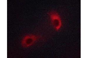 ABIN6267313 staining Jurkat cells by ICC/IF. (LCK 抗体  (pTyr393))