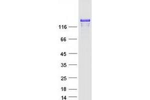Western Blotting (WB) image for Membrane Associated Guanylate Kinase, WW and PDZ Domain Containing 2 (MAGI2) protein (Myc-DYKDDDDK Tag) (ABIN2725223)