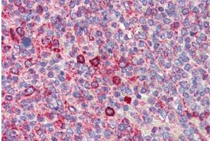 Human Spleen (formalin-fixed, paraffin-embedded) stained with BCL11A antibody ABIN462216 followed by biotinylated goat anti-rabbit IgG secondary antibody ABIN481713, alkaline phosphatase-streptavidin and chromogen. (BCL11A 抗体  (N-Term))