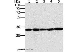 Western blot analysis of Human testis tissue and K562 cell, PC3 cell and human liver cancer tissue, hela cell, using MTCH2 Polyclonal Antibody at dilution of 1:400 (MTCH2 抗体)