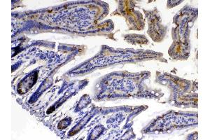 IHC analysis of Xanthine Oxidase using anti-Xanthine Oxidase antibody . (XDH 抗体  (AA 2-343))