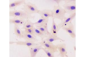 ICC testing of human A549 cells with Beta Catenin antibody. (beta Catenin 抗体  (AA 2-233))