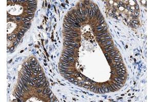 ABIN6266881 at 1/100 staining human Colorectal tissue sections by IHC-P. (HDAC5 抗体  (C-Term))