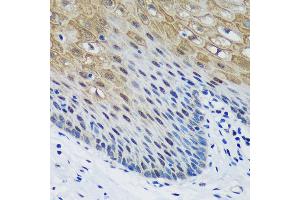Immunohistochemistry of paraffin-embedded Human esophageal using PSPC1 Rabbit pAb (ABIN6132925, ABIN6146363, ABIN6146364 and ABIN6224928) at dilution of 1:100 (40x lens). (PSPC1 抗体  (AA 1-70))