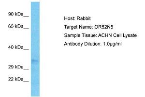 Western Blotting (WB) image for anti-Olfactory Receptor, Family 52, Subfamily N, Member 5 (OR52N5) (C-Term) antibody (ABIN2791835)