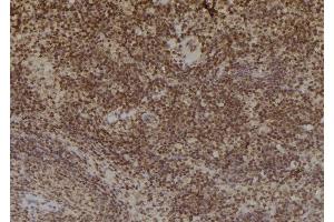 ABIN6269033 at 1/100 staining Mouse spleen tissue by IHC-P. (TYR 抗体)