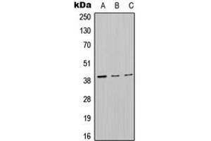Western blot analysis of MT-ND2 expression in HepG2 (A), Raw264. (MT-ND2 抗体  (Center))