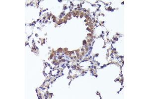 Immunohistochemistry of paraffin-embedded mouse lung using CRCP Rabbit pAb (ABIN1679351, ABIN3019127, ABIN3019128 and ABIN6220728) at dilution of 1:200 (40x lens). (CRCP 抗体  (AA 1-115))