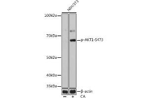 Western blot analysis of extracts of NIH/3T3 cells, using Phospho--S473 mAb (ABIN6135179, ABIN6135970, ABIN6135971 and ABIN7101880) at 1:1000 dilution. (AKT1 抗体  (pSer473))