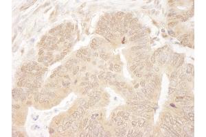Immunohistochemistry (IHC) image for anti-Kinesin Family Member 2C (KIF2C) (AA 50-100) antibody (ABIN7448646)