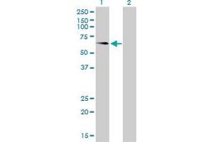 Western Blot analysis of ALPL expression in transfected 293T cell line by ALPL monoclonal antibody (M01), clone 4H1. (ALPL 抗体  (AA 91-200))