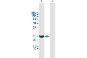 Western Blot analysis of CINP expression in transfected 293T cell line by CINP MaxPab polyclonal antibody. (CINP 抗体  (AA 1-212))