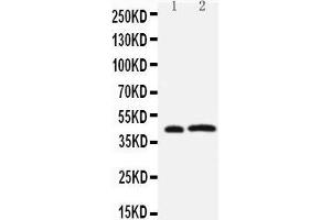 Anti-Leupaxin antibody, Western blotting Lane 1: Rat Thymus Tissue Lysate Lane 2: JURKAT Cell Lysate