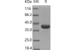 MDH1 Protein (His tag)