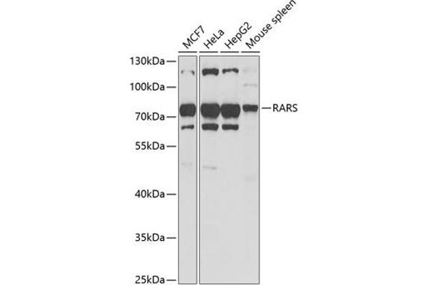 RARS Antikörper  (AA 1-300)