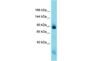 Host: Rabbit  Target Name: Nefm  Sample Tissue: Rat Muscle lysates  Antibody Dilution: 1. (NEFM 抗体  (C-Term))