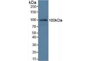 Detection of C7 in Rat Serum using Polyclonal Antibody to Complement Component 7 (C7) (C7 抗体  (AA 1-144))