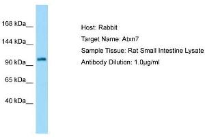 Host: Rabbit  Target Name: Atxn7  Sample Tissue: Rat Small Intestine lysates  Antibody Dilution: 1. (ATXN7 抗体  (N-Term))