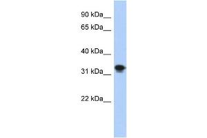 WB Suggested Anti-CENPP Antibody Titration: 0. (CENPP 抗体  (N-Term))