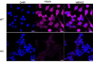 Immunocytochemical staining of HeLa cells using STAT1 antibody (ABIN7800336), 1:1,000), Top panel: wild-type (WT), Bottom panal: STAT1 shRNA knockdown (KD). (Recombinant STAT1 抗体)