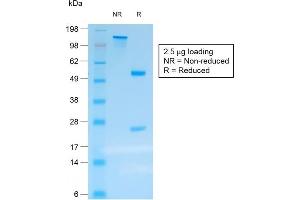 SDS-PAGE Analysis Purified Chromogranin A Mouse Recombinant Monoclonal Ab (rCHGA/413). (Recombinant Chromogranin A 抗体)