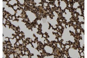 ABIN6264405 and ABIN6274040 at 1/100 staining Mouse lung tissue by IHC-P.