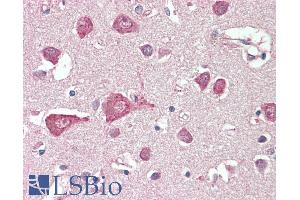 ABIN1590116 (5µg/ml) staining of paraffin embedded Human Cortex. (MLC1 抗体  (AA 179-193))