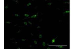 Immunofluorescence of monoclonal antibody to PDE5A on HeLa cell. (PDE5A 抗体  (AA 29-138))