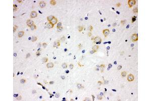 Anti-PAK6 antibody, IHC(P) IHC(P): Rat Brain Tissue (PAK6 抗体  (N-Term))